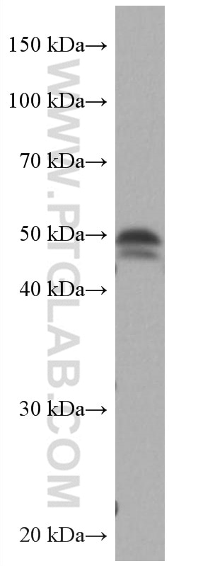 Western Blot (WB) analysis of HeLa cells using ATX3,ATXN3 Monoclonal antibody (67057-1-Ig)