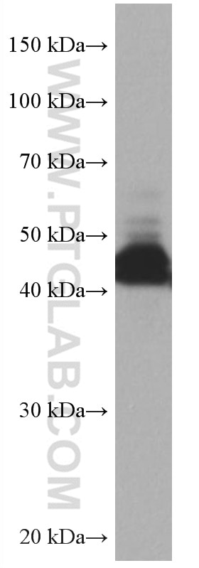 Western Blot (WB) analysis of Jurkat cells using ATX3,ATXN3 Monoclonal antibody (67057-1-Ig)