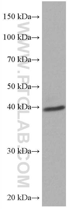 Western Blot (WB) analysis of mouse brain tissue using ATX3,ATXN3 Monoclonal antibody (67057-1-Ig)