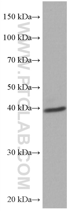 WB analysis of mouse brain using 67057-1-Ig