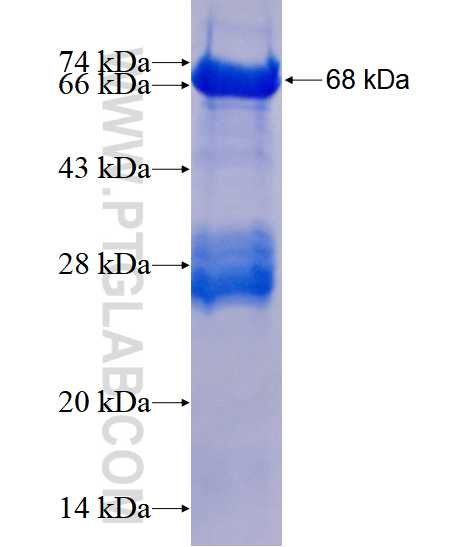 ATX3,ATXN3 fusion protein Ag4341 SDS-PAGE