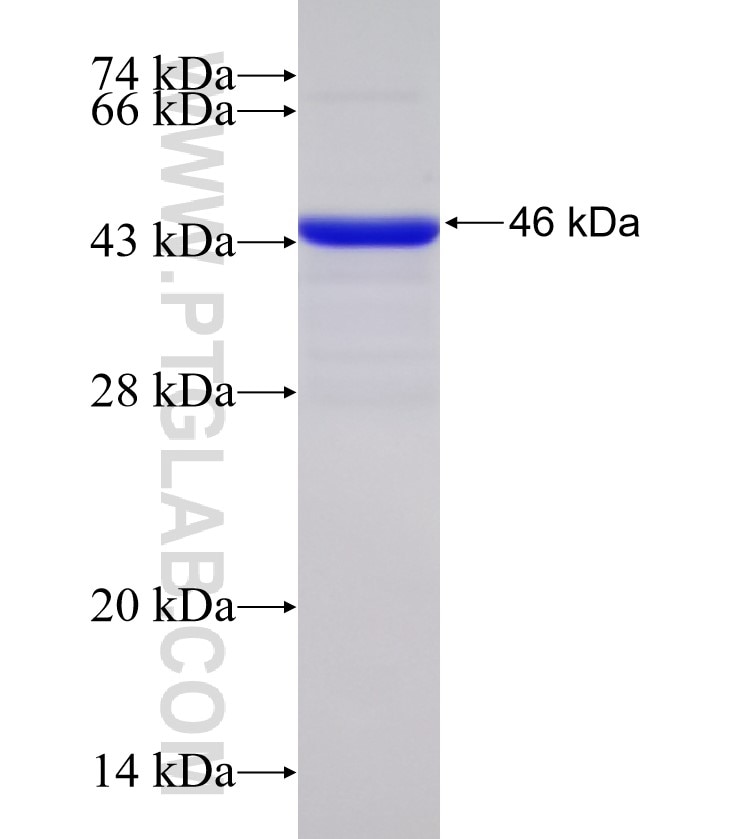 ATXN1 fusion protein Ag31136 SDS-PAGE ATXN1 fusion protein Ag31136 SDS-PAGE