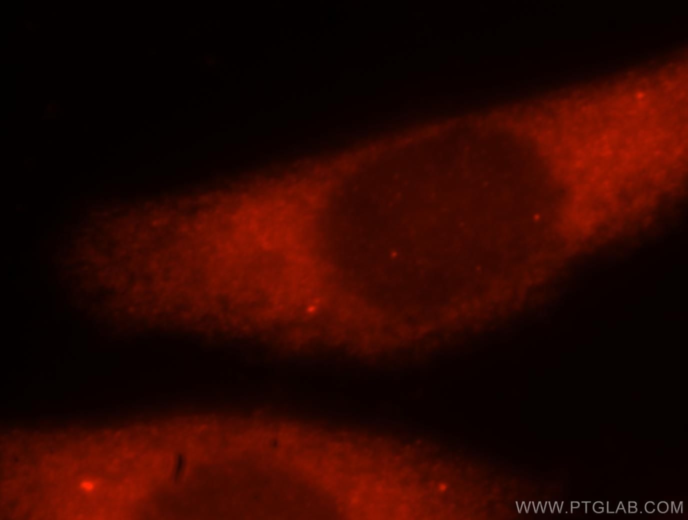 Immunofluorescence (IF) / fluorescent staining of HeLa cells using ATXN10 Polyclonal antibody (15693-1-AP)