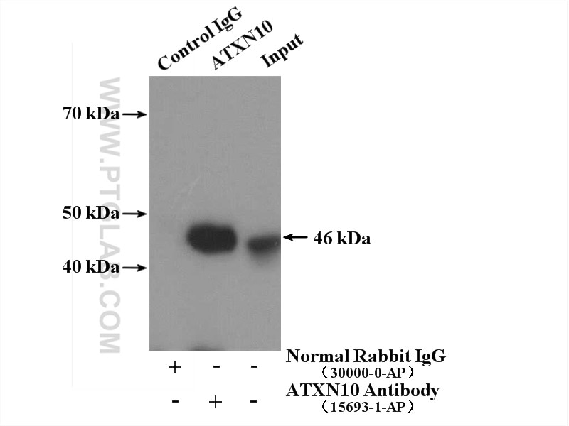 Immunoprecipitation (IP) experiment of A431 cells using ATXN10 Polyclonal antibody (15693-1-AP)