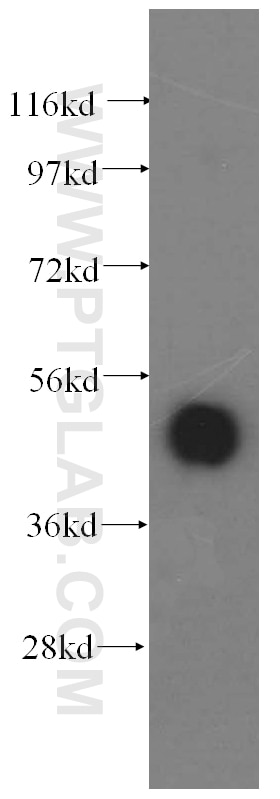 Western Blot (WB) analysis of human brain tissue using ATXN10 Polyclonal antibody (15693-1-AP)