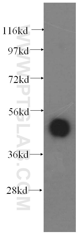 Western Blot (WB) analysis of human brain tissue using ATXN10 Polyclonal antibody (15693-1-AP)