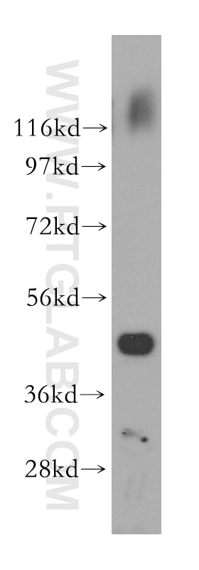 Western Blot (WB) analysis of human kidney tissue using ATXN10 Polyclonal antibody (15693-1-AP)