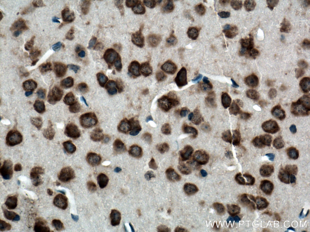 Immunohistochemistry (IHC) staining of mouse brain tissue using Ataxin 2 Polyclonal antibody (21776-1-AP)