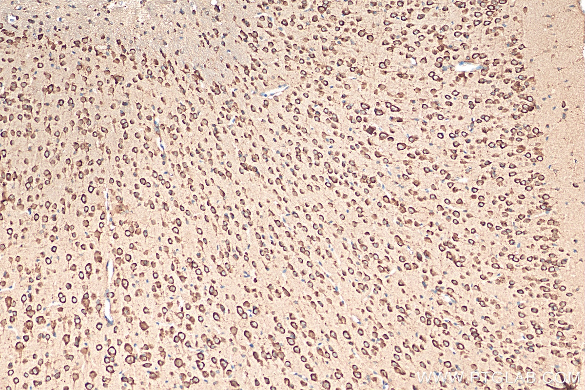 Immunohistochemistry (IHC) staining of mouse brain tissue using Ataxin 2 Polyclonal antibody (21776-1-AP)