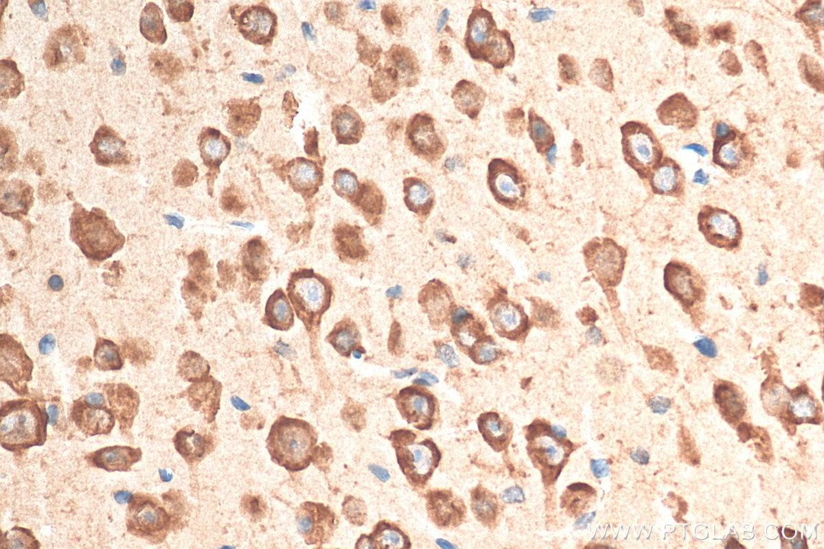 Immunohistochemistry (IHC) staining of mouse brain tissue using Ataxin 2 Polyclonal antibody (21776-1-AP)