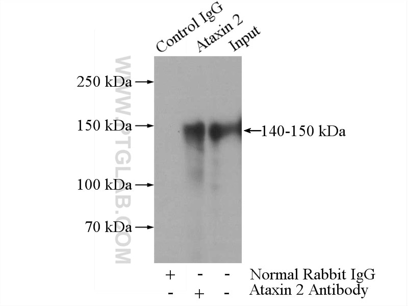 Immunoprecipitation (IP) experiment of HEK-293 cells using Ataxin 2 Polyclonal antibody (21776-1-AP)