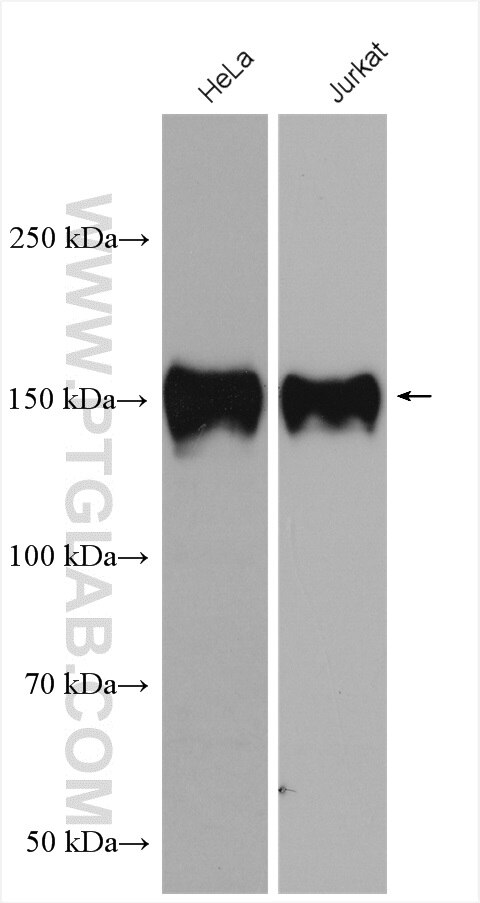 Ataxin 2 Polyclonal antibody