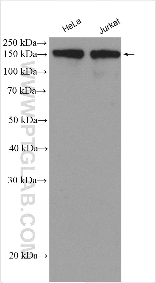 Western Blot (WB) analysis of various lysates using Ataxin 2 Polyclonal antibody (21776-1-AP)