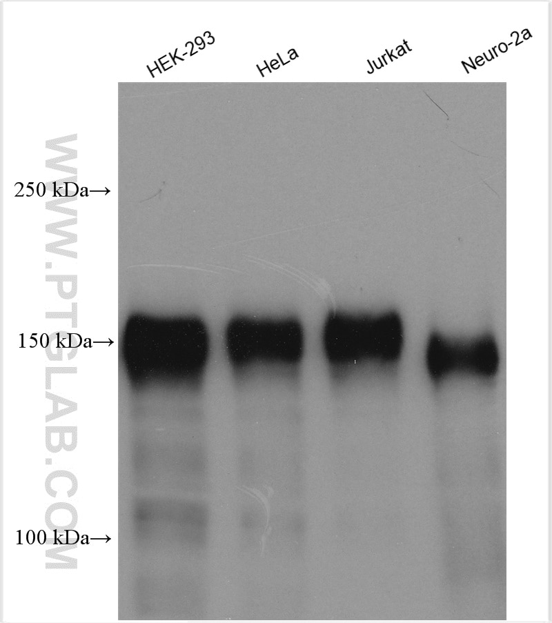 Western Blot (WB) analysis of various lysates using Ataxin 2 Polyclonal antibody (21776-1-AP)