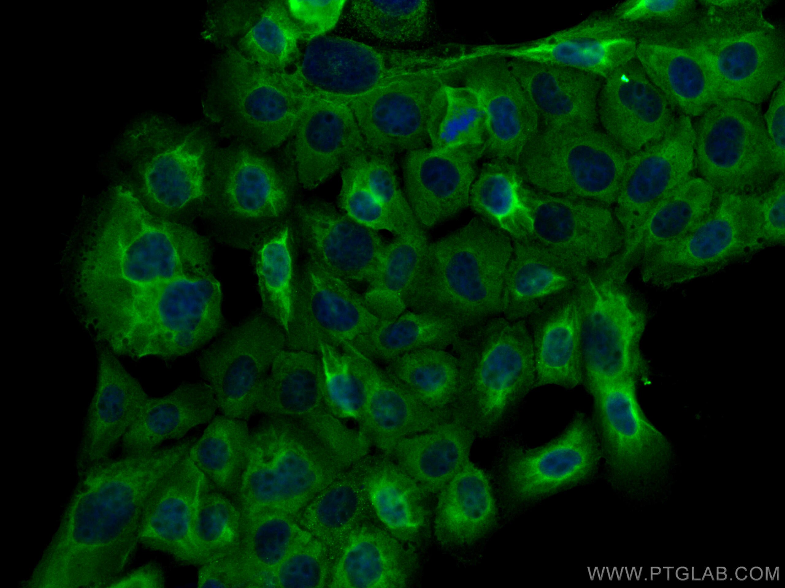 Immunofluorescence (IF) / fluorescent staining of A431 cells using ATXN2L PolyClonal antibody (24822-1-AP)