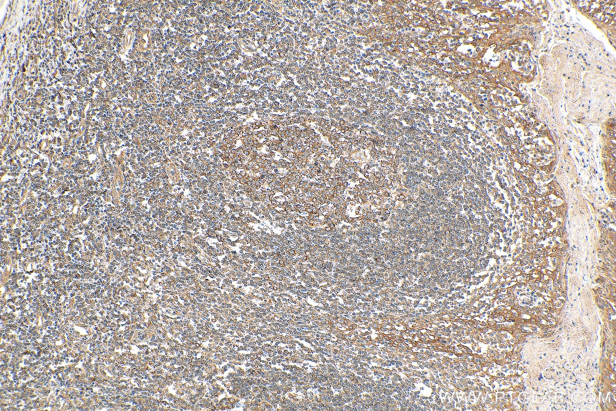 Immunohistochemistry (IHC) staining of human tonsillitis tissue using ATXN2L PolyClonal antibody (24822-1-AP)