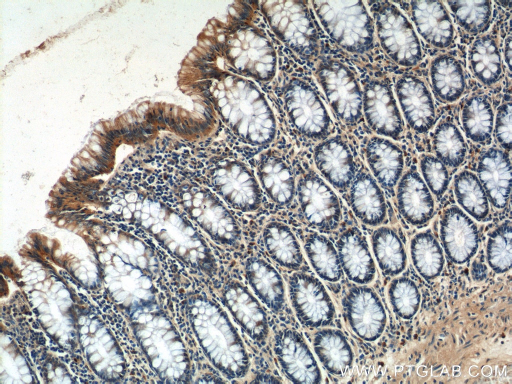 IHC staining of human colon using 24822-1-AP