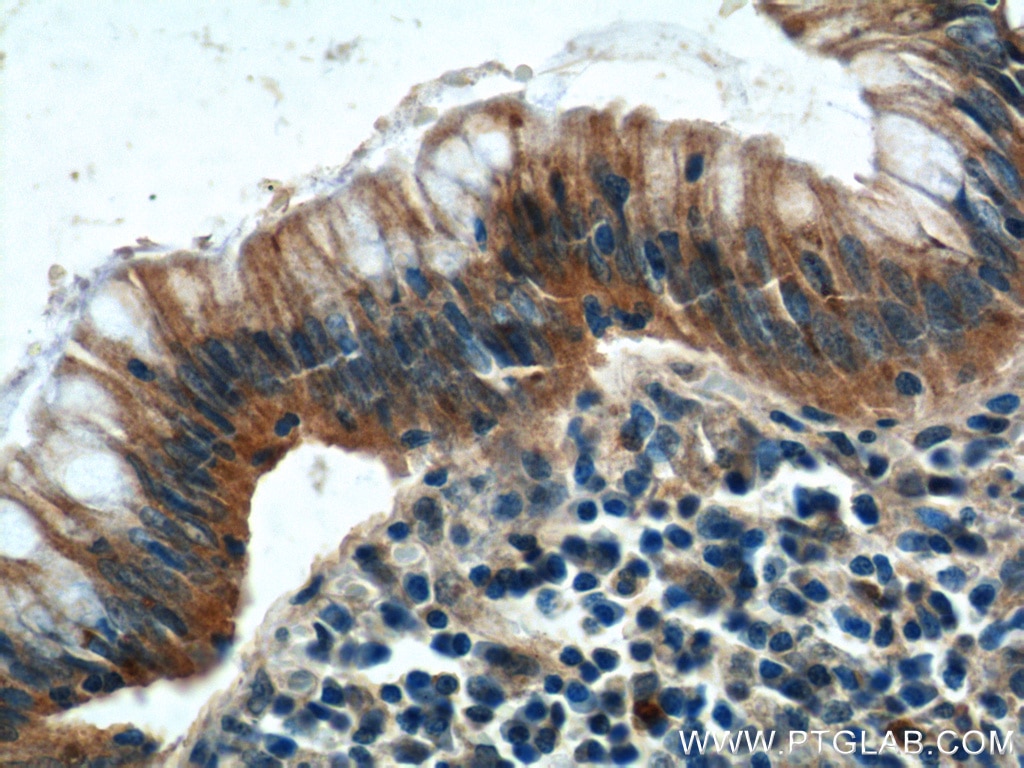 IHC staining of human colon using 24822-1-AP