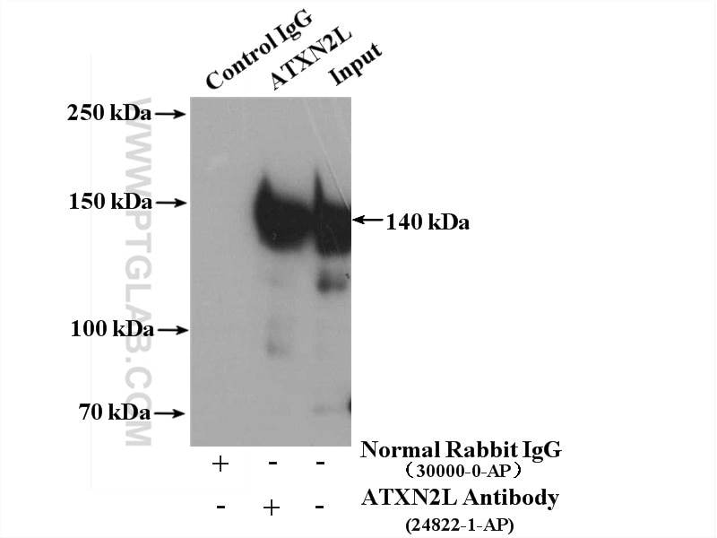 Immunoprecipitation (IP) experiment of HeLa cells using ATXN2L PolyClonal antibody (24822-1-AP)