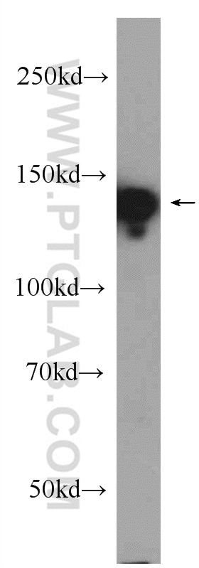 Western Blot (WB) analysis of Jurkat cells using ATXN2L PolyClonal antibody (24822-1-AP)