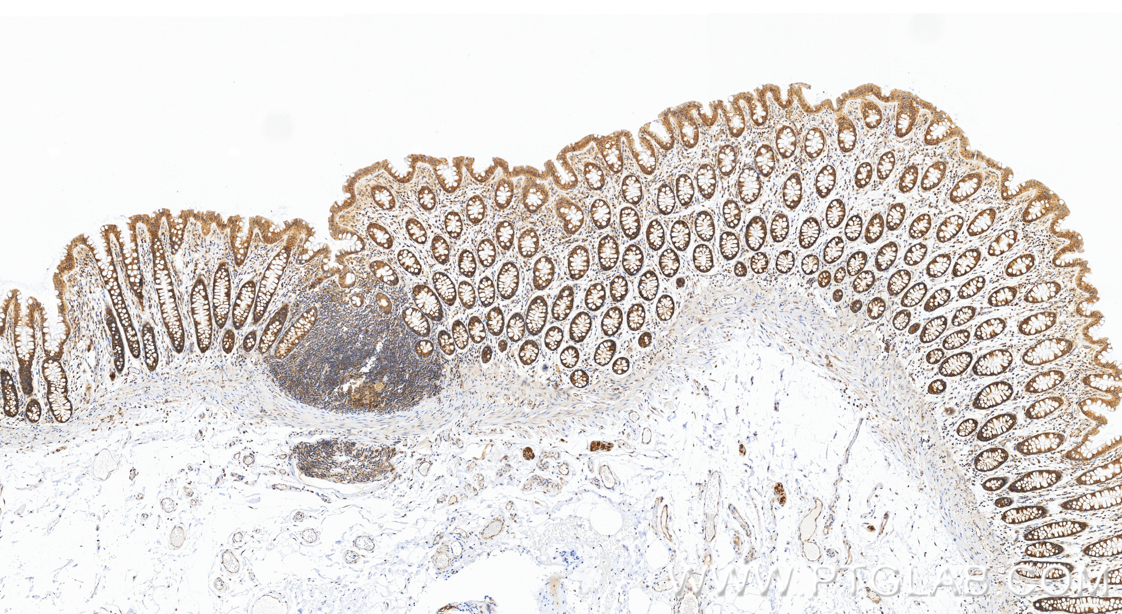 IHC staining of human colon using 86613-3-RR (same clone as 86613-3-PBS) Immunohistochemistry (IHC) staining of human colon tissue using ATXN2L Recombinant monoclonal antibody (86613-3-RR)