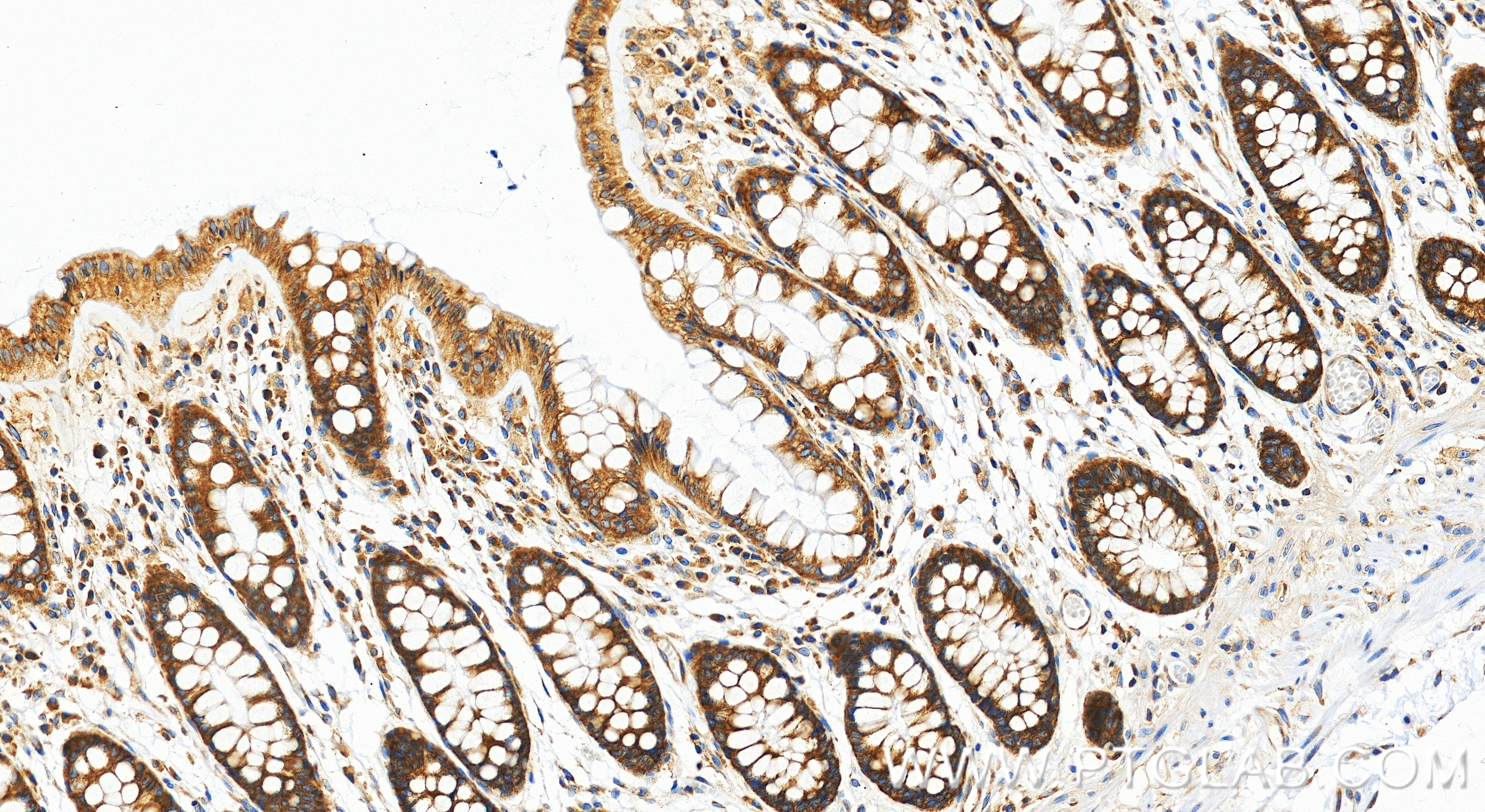 IHC staining of human colon using 86613-3-RR (same clone as 86613-3-PBS) Immunohistochemistry (IHC) staining of human colon tissue using ATXN2L Recombinant monoclonal antibody (86613-3-RR)