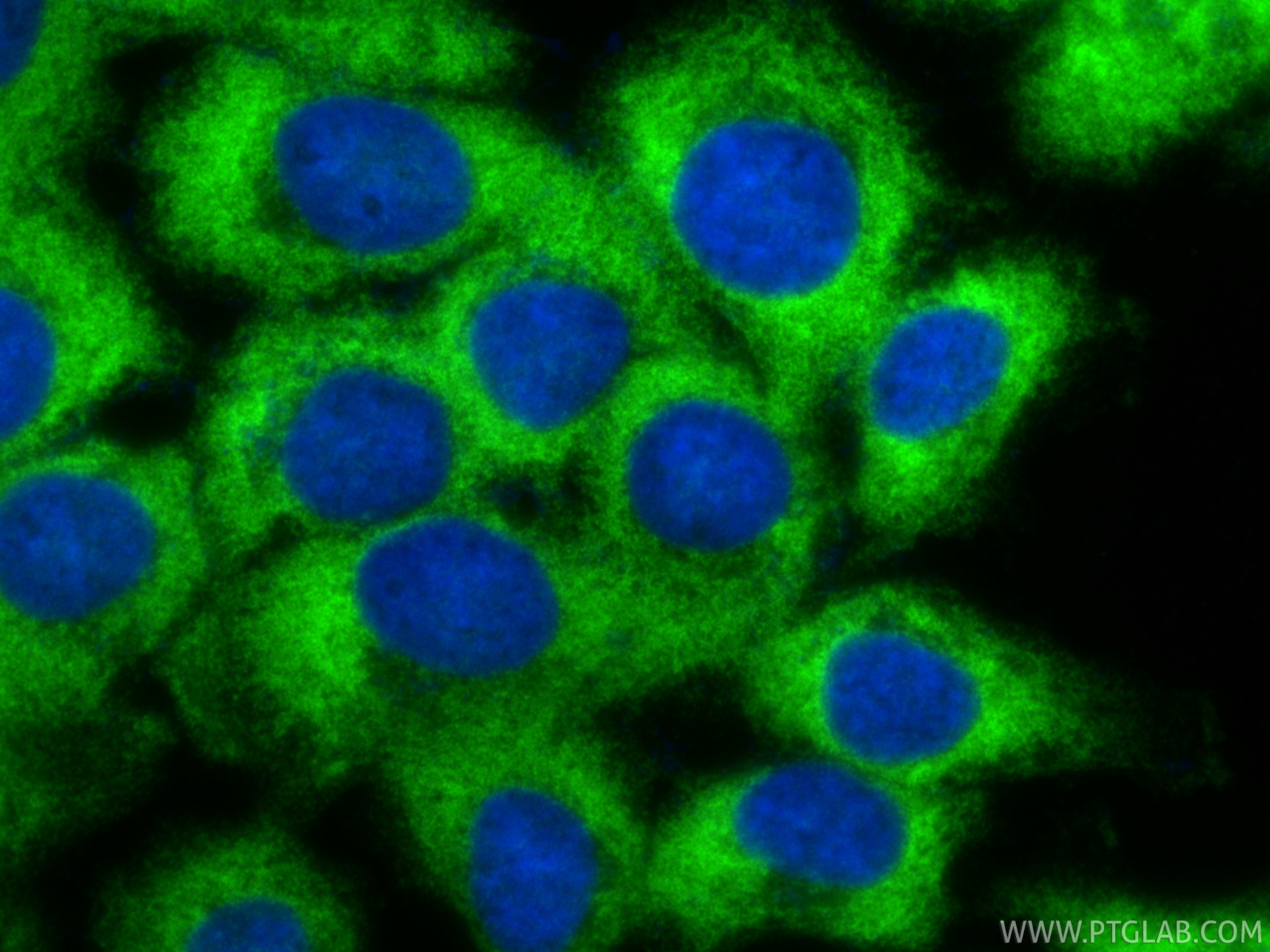 Immunofluorescence (IF) / fluorescent staining of A431 cells using ATXN2L Recombinant monoclonal antibody (86613-3-RR)