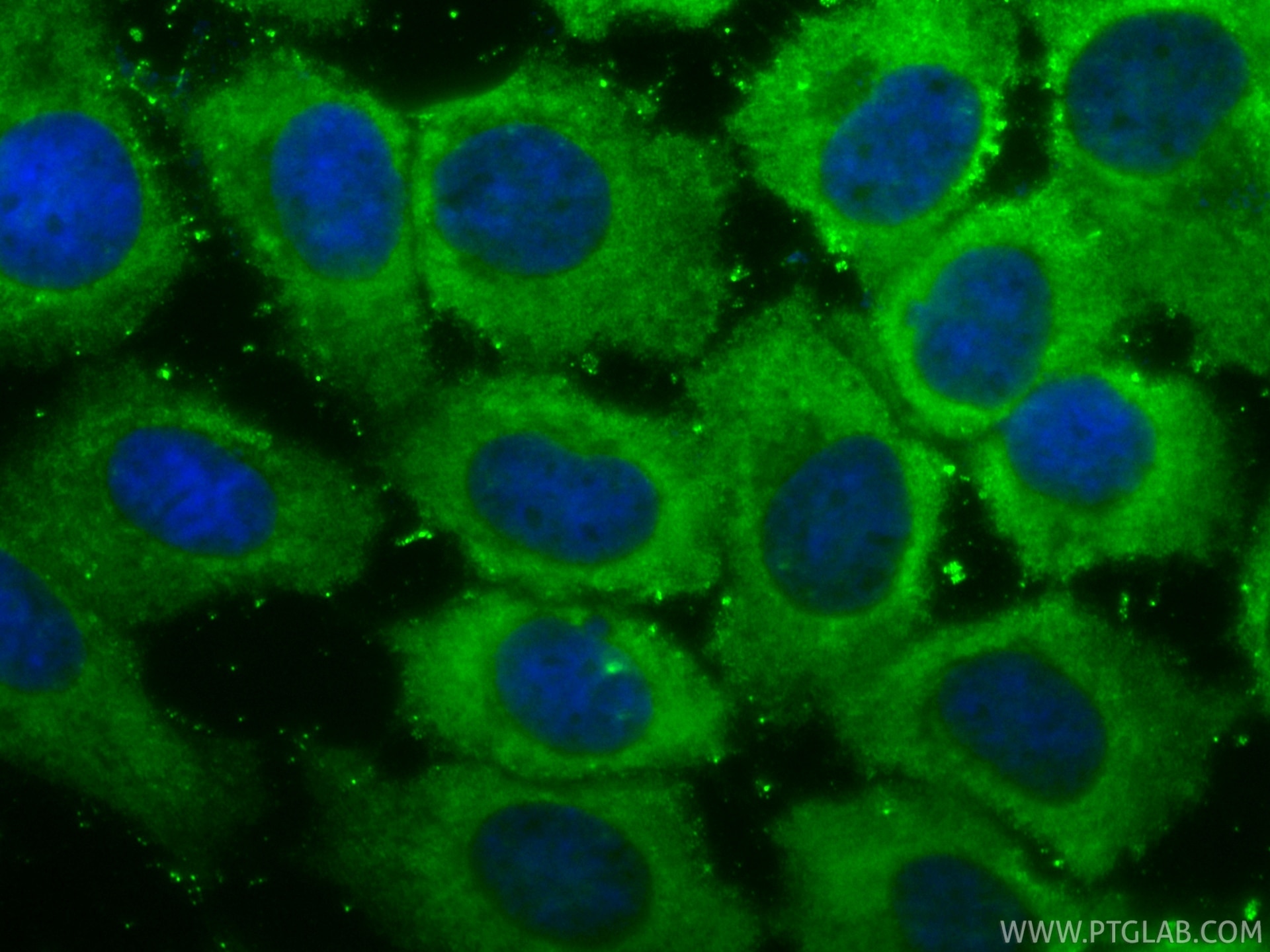 Immunofluorescence (IF) / fluorescent staining of A431 cells using CoraLite® Plus 488-conjugated ATXN2L Recombinant m (CL488-86613-3)