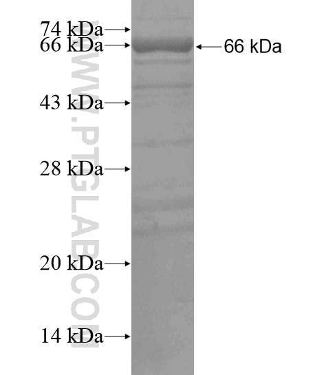 ATXN2L fusion protein Ag20581 SDS-PAGE
