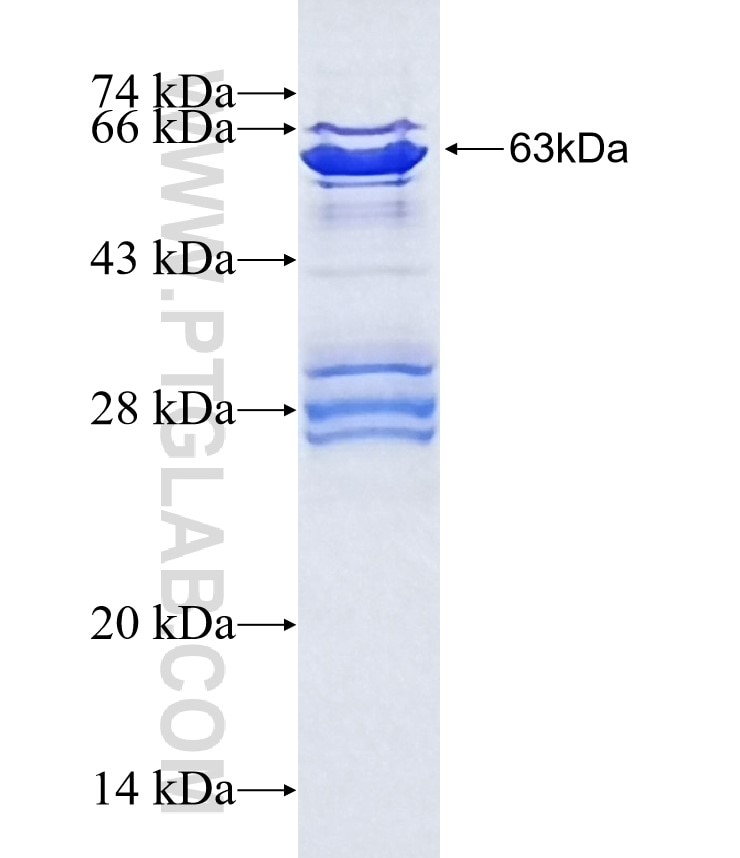 ATXN2L fusion protein Ag20581 SDS-PAGE