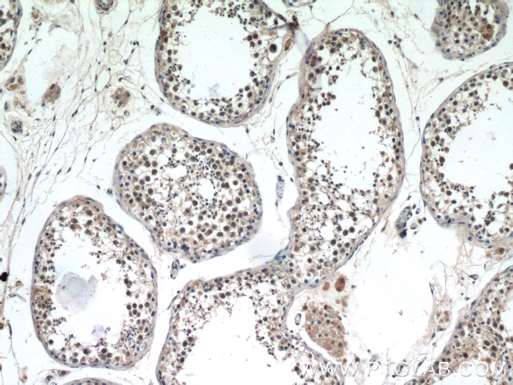 Immunohistochemistry (IHC) staining of human testis tissue using ATXN3L Polyclonal antibody (23166-1-AP)