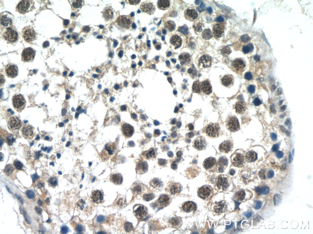 Immunohistochemistry (IHC) staining of human testis tissue using ATXN3L Polyclonal antibody (23166-1-AP)