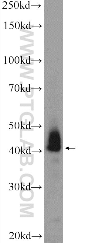 Western Blot (WB) analysis of human testis tissue using ATXN3L Polyclonal antibody (23166-1-AP)