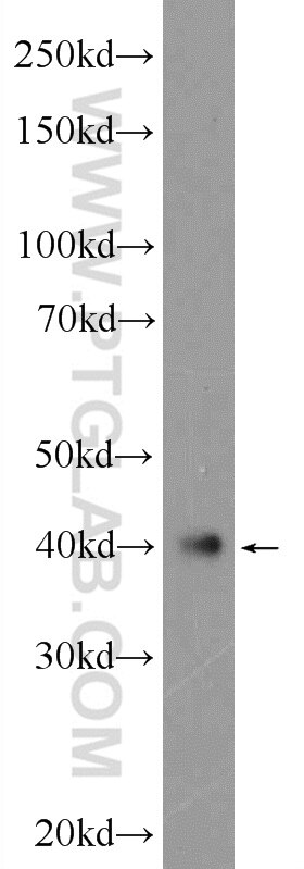 Western Blot (WB) analysis of human testis tissue using ATXN3L Polyclonal antibody (25099-1-AP)