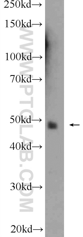 Western Blot (WB) analysis of mouse brain tissue using ATXN3L Polyclonal antibody (25099-1-AP)