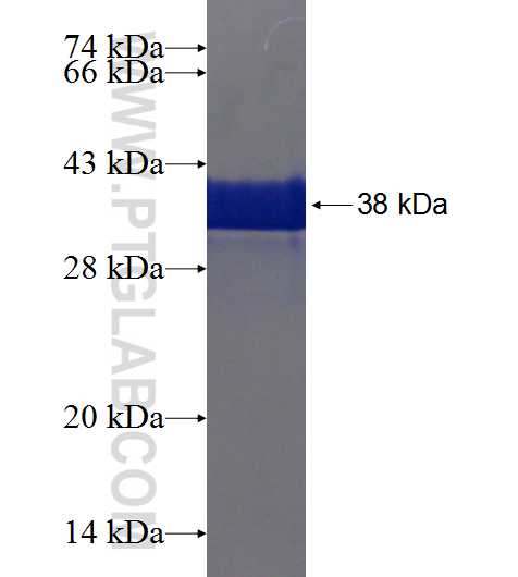 ATXN3L fusion protein Ag18740 SDS-PAGE