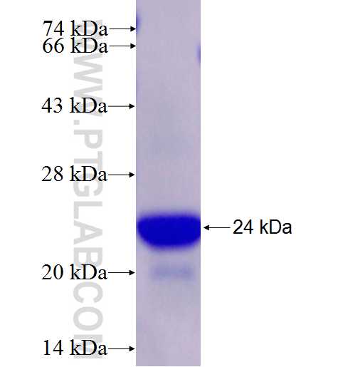 ATXN7 fusion protein Ag26806 SDS-PAGE
