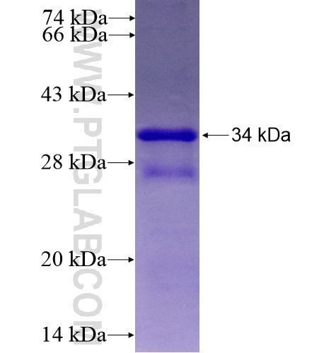 ATXN7L1 fusion protein Ag10123 SDS-PAGE
