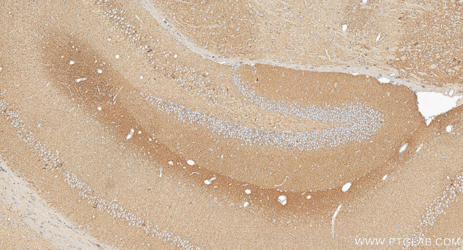 Immunohistochemistry (IHC) staining of mouse brain tissue using AUH Polyclonal antibody (17079-1-AP)