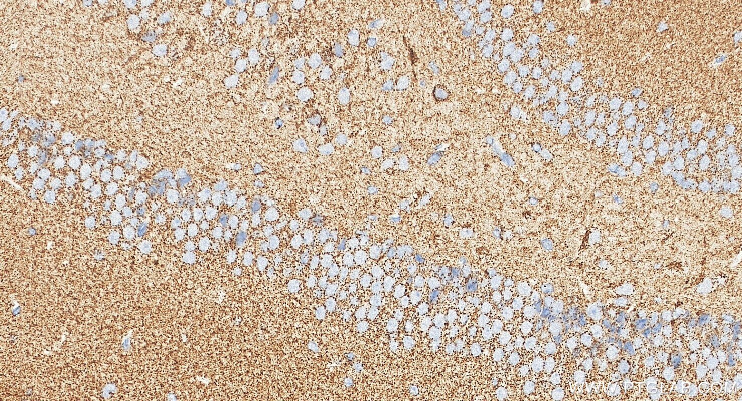 Immunohistochemistry (IHC) staining of mouse brain tissue using AUH Polyclonal antibody (17079-1-AP)