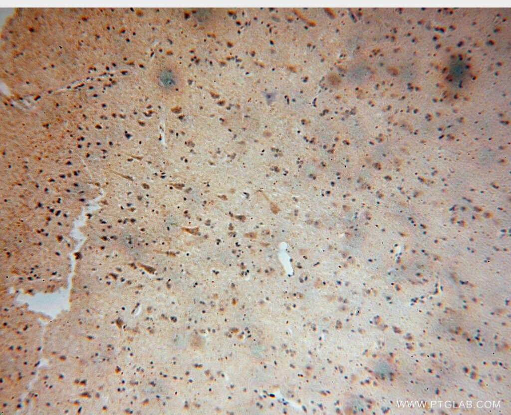 Immunohistochemistry (IHC) staining of human brain tissue using AUH Polyclonal antibody (17079-1-AP)