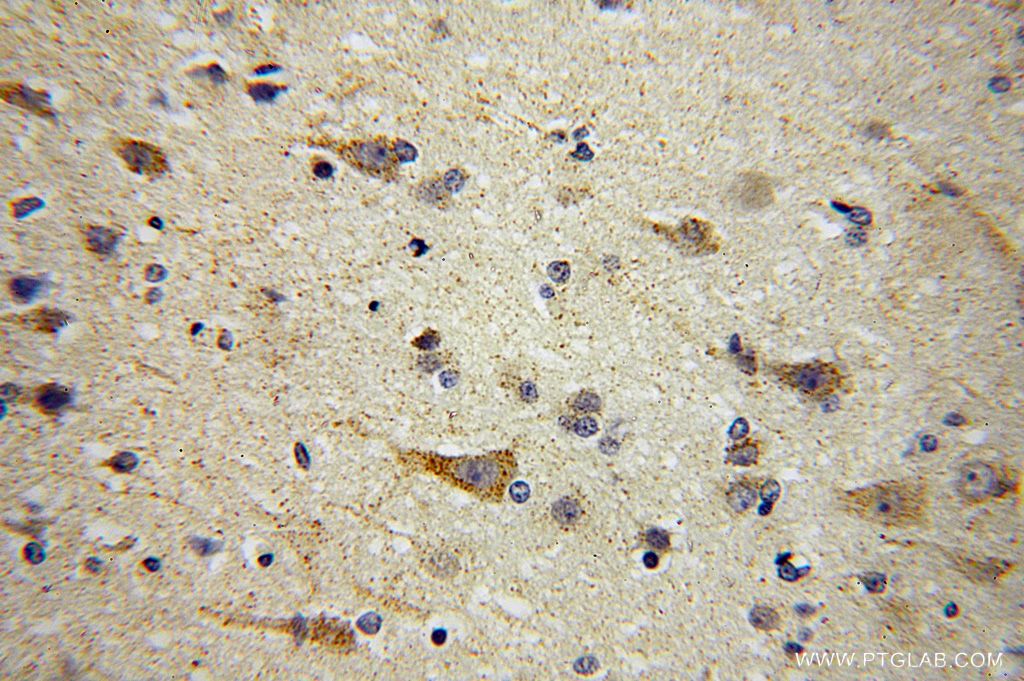 Immunohistochemistry (IHC) staining of human brain tissue using AUH Polyclonal antibody (17079-1-AP)