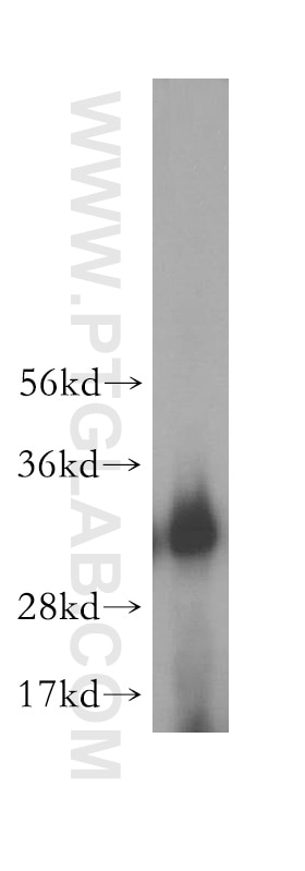 Western Blot (WB) analysis of human brain tissue using AUH Polyclonal antibody (17079-1-AP)