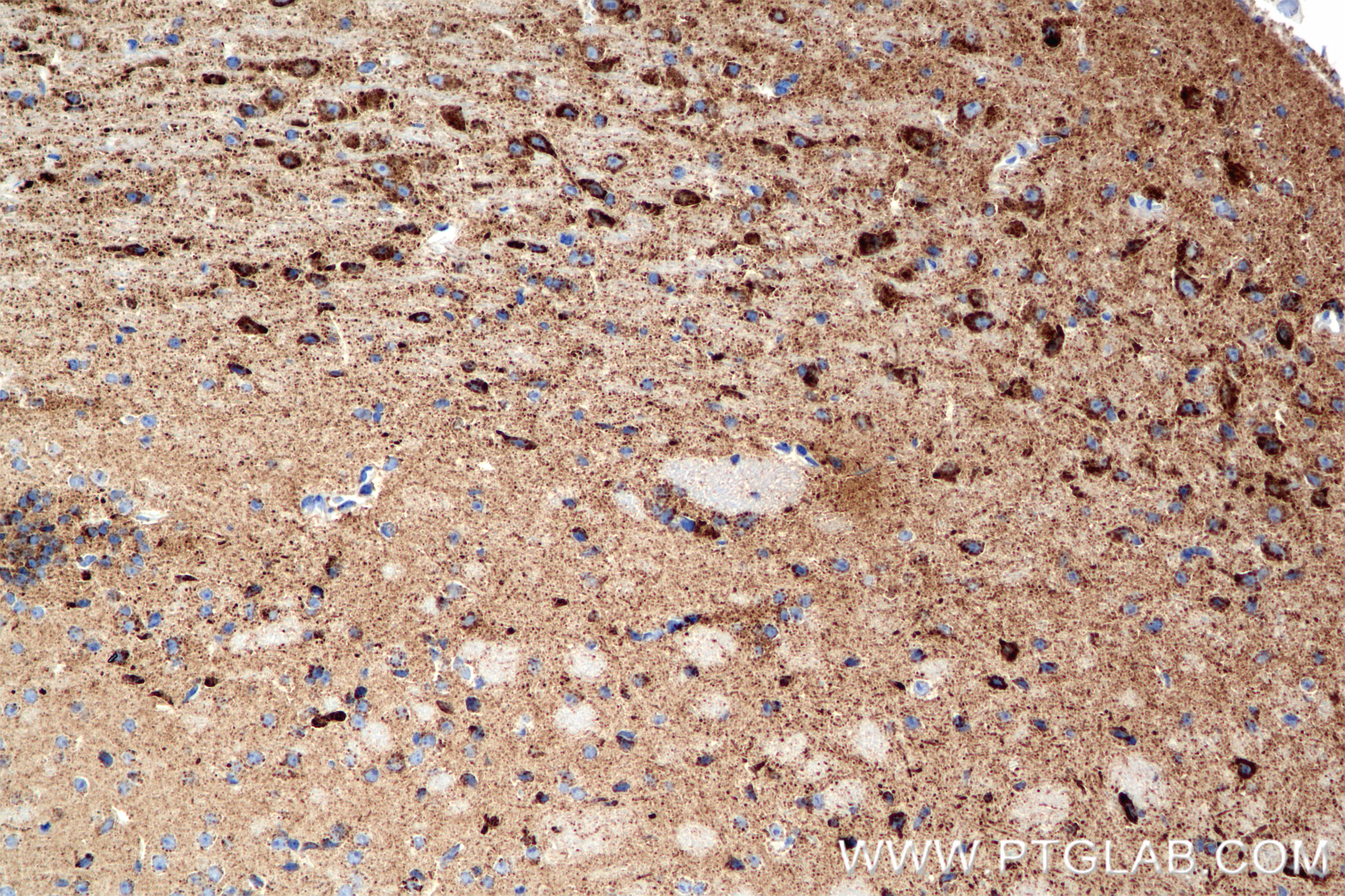 Immunohistochemistry (IHC) staining of mouse brain tissue using AUH Recombinant monoclonal antibody (85421-1-RR)