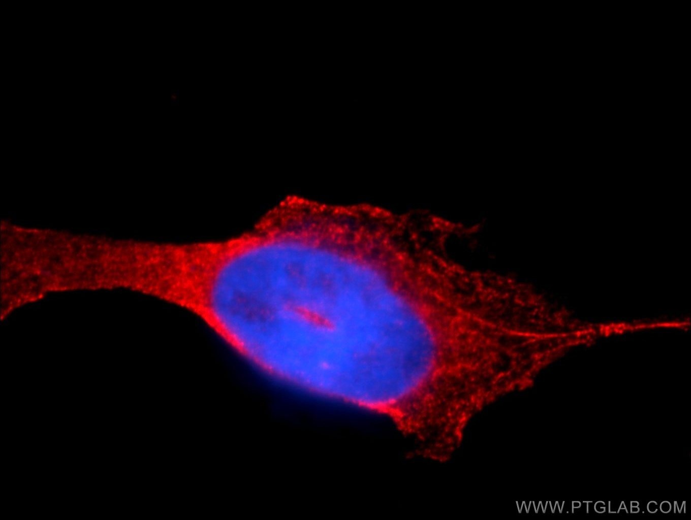 Immunofluorescence (IF) / fluorescent staining of A431 cells using AUP1 Polyclonal antibody (13726-1-AP)