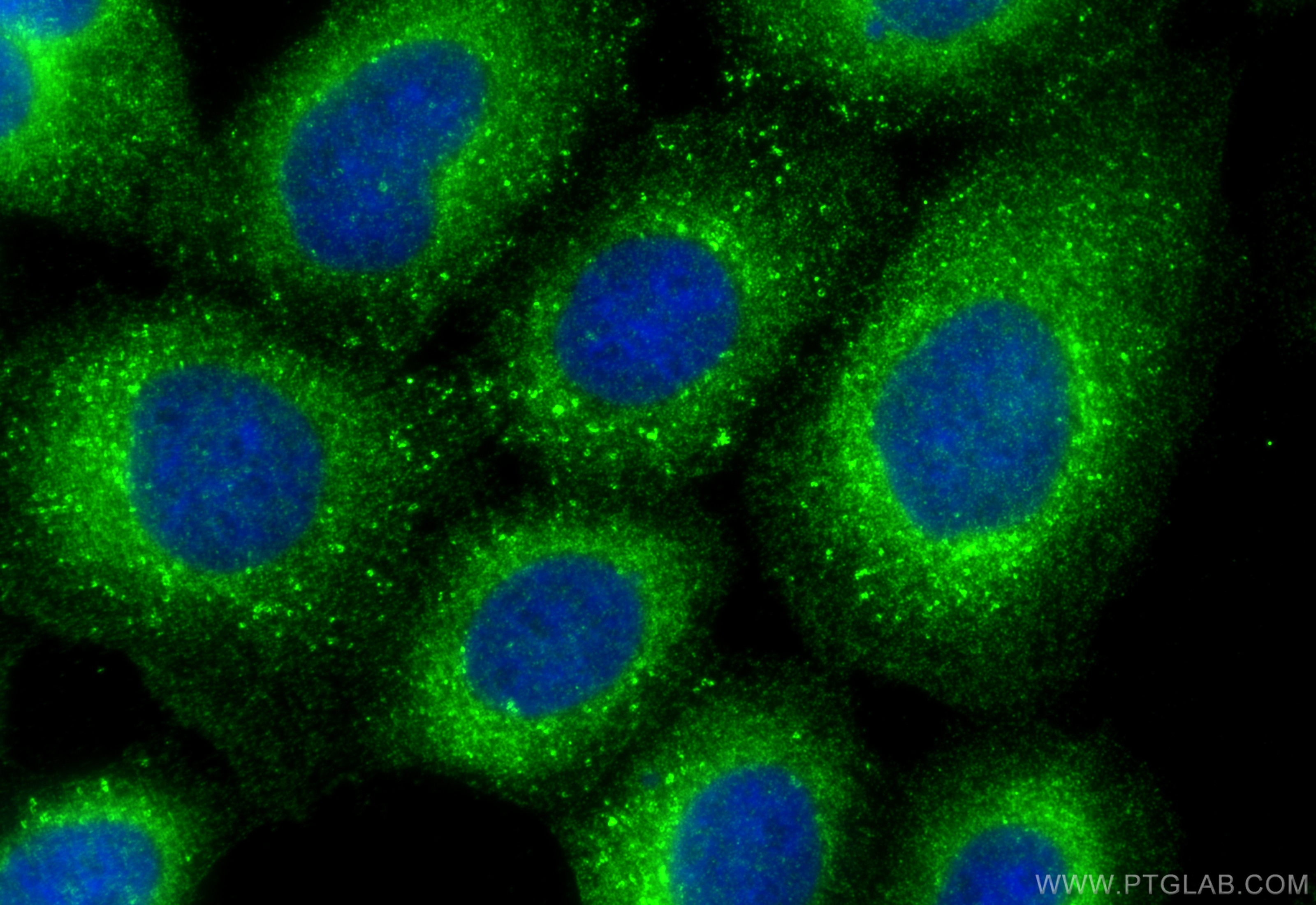 Immunofluorescence (IF) / fluorescent staining of A431 cells using AUP1 Polyclonal antibody (13726-1-AP)