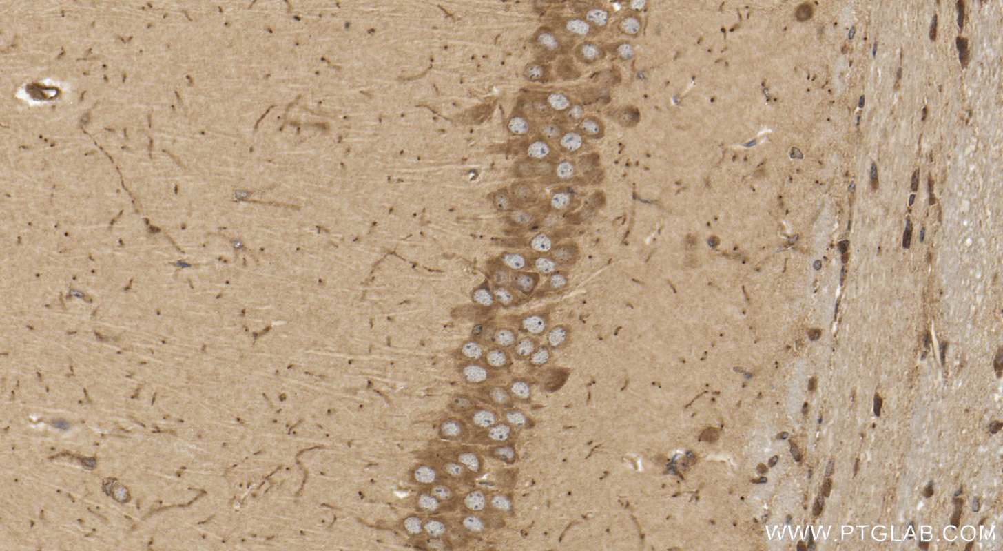 Immunohistochemistry (IHC) staining of mouse brain tissue using AUP1 Polyclonal antibody (13726-1-AP)