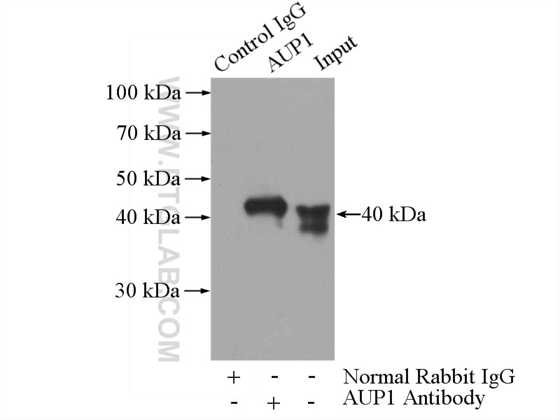 Immunoprecipitation (IP) experiment of HEK-293 cells using AUP1 Polyclonal antibody (13726-1-AP)
