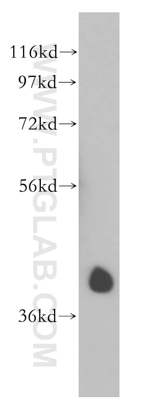 Western Blot (WB) analysis of HEK-293 cells using AUP1 Polyclonal antibody (13726-1-AP)