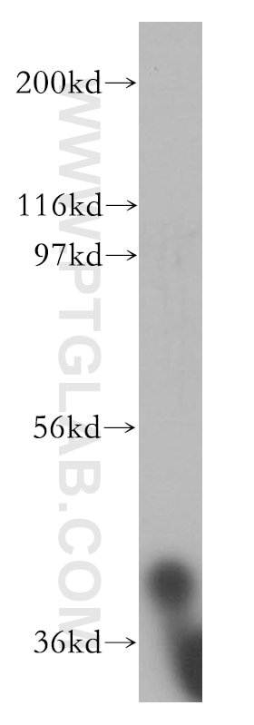 Western Blot (WB) analysis of Jurkat cells using AUP1 Polyclonal antibody (13726-1-AP)